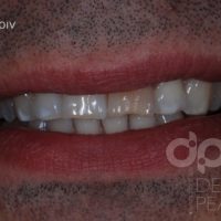 smile design dental pearls