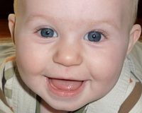 How much is your smile worth?