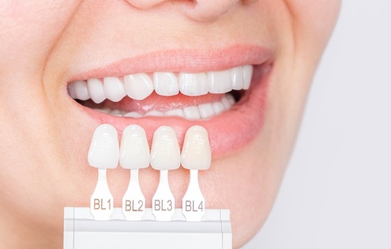 Banner,Tooth,Whitening,,Perfect,White,Crown,Teeth,Close,Up,With