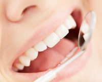 Σφραγίσματα δοντιών: Η ιδανική λύση για την προληπτική προστασία των δοντιών σας